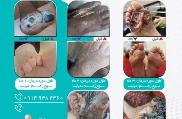 شرکت داروسازی ترمیم بافت جهانیارا؛ پیشتاز در تولید داروهای گیاهی برای درمان بیماریهای مزمن شرکت داروسازی ترمیم بافت جهانیارا؛ پیشتاز در تولید داروهای گیاهی برای درمان بیماریهای مزمن